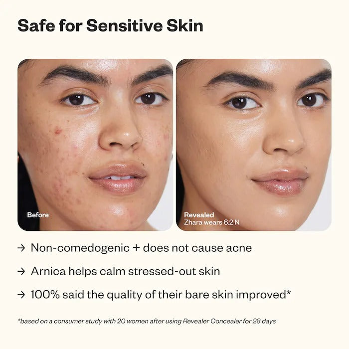CalmCover Concealer